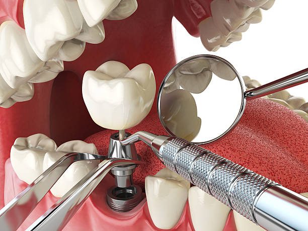Trusted MO Emergency Dental Service Experts