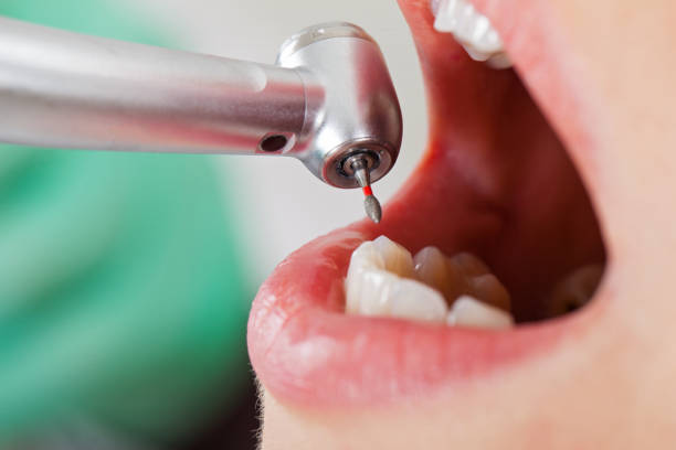 Best Emergency Denture Repair in Kirksville, MO